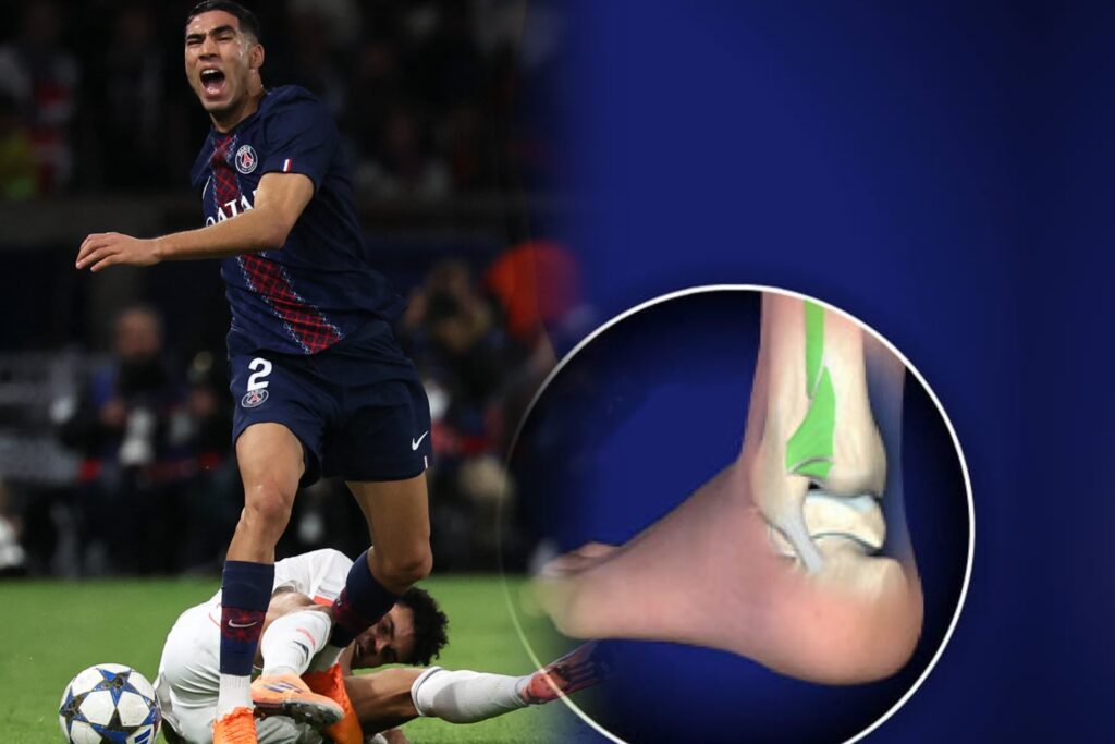 قلق في معسكر المنتخب المغربي بعد إصابة حكيمي واحتمال غيابه عن الكان